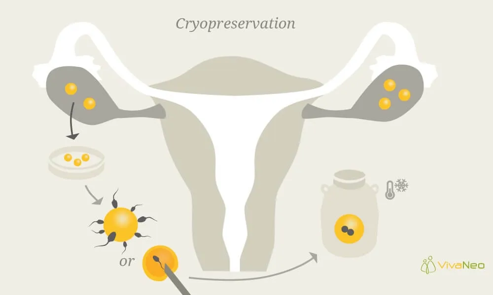 cryopreservation